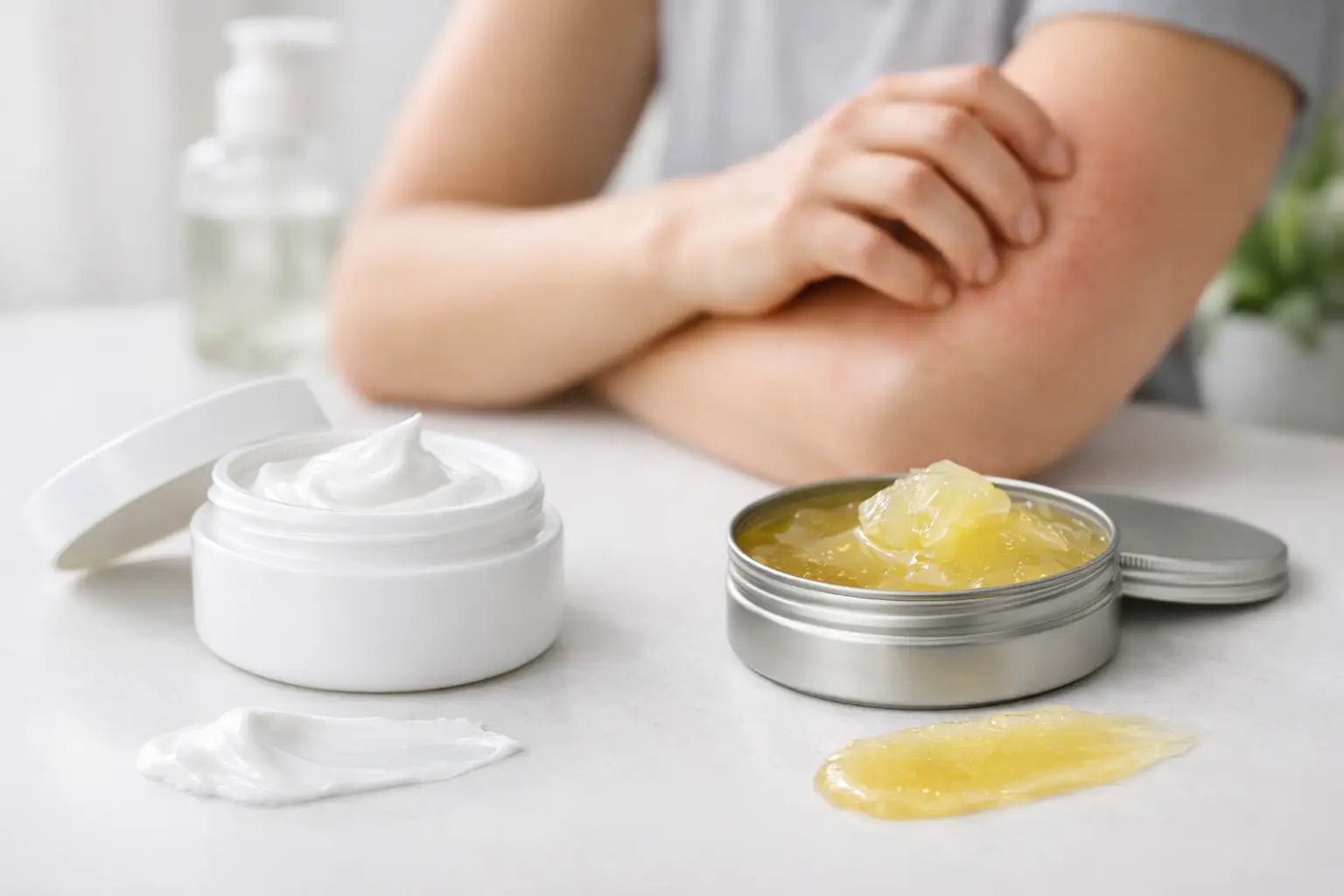 Cream vs Ointment for Eczema - Which Works Best?