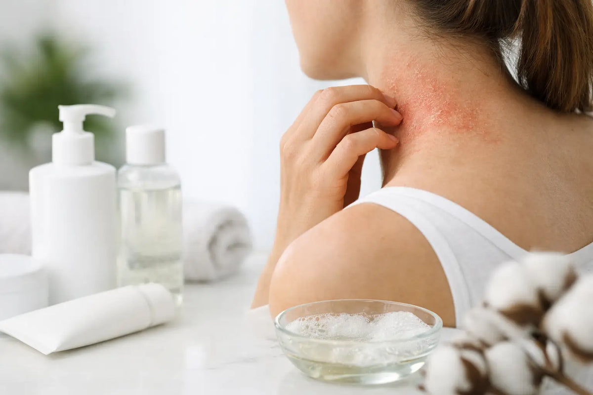 Can Cleansers Worsen Eczema? What to Know