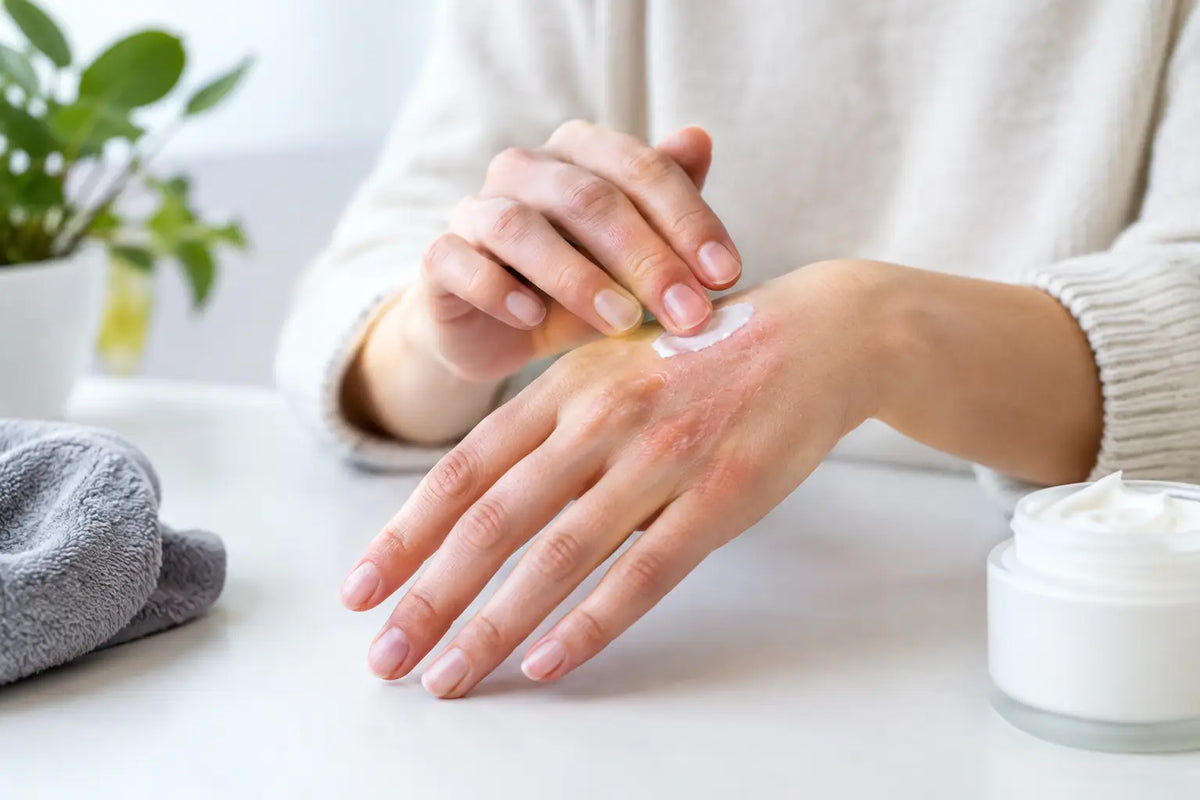 Hand Dermatitis: Relief, Repair, and Prevention