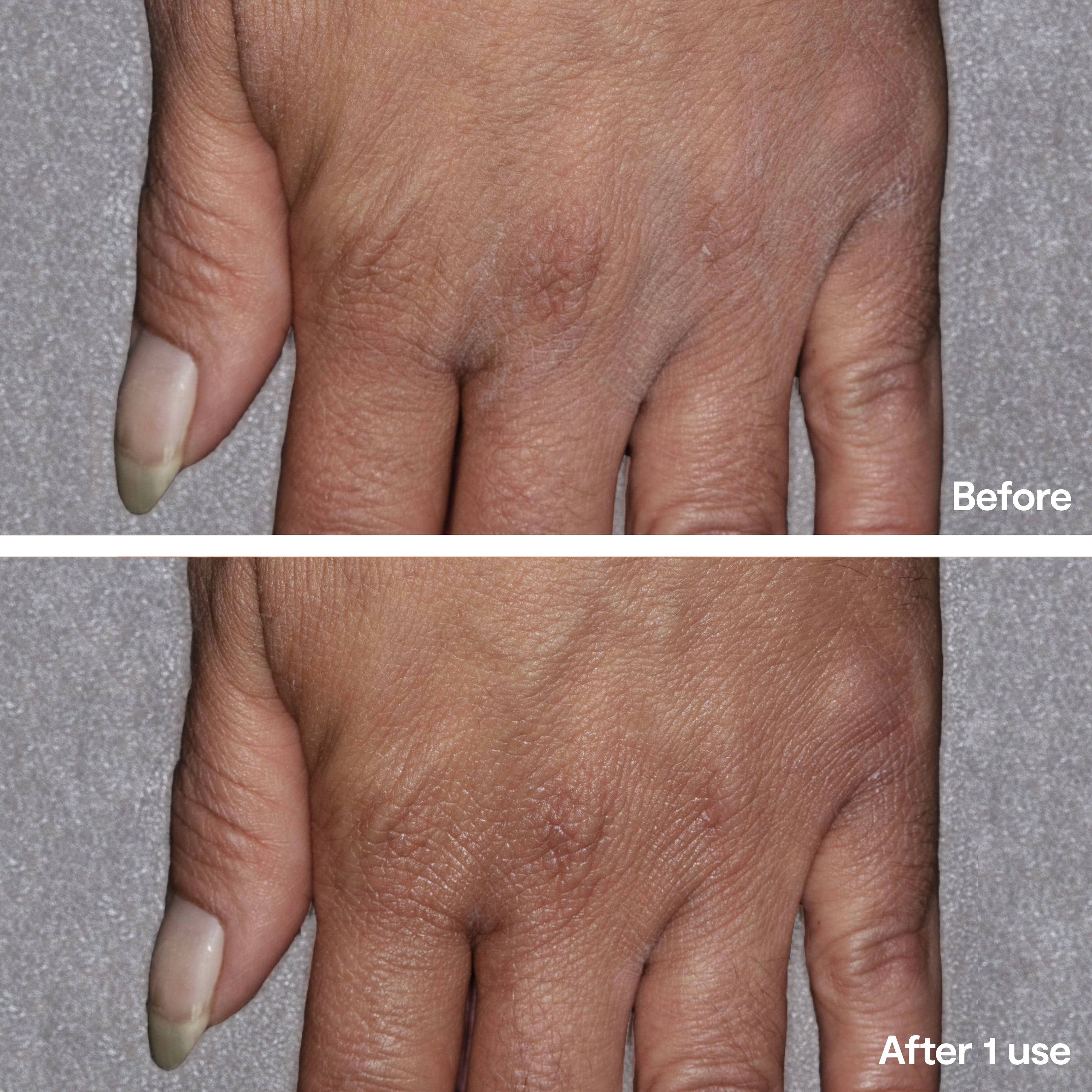 Barrier Renewal Hand Cream
